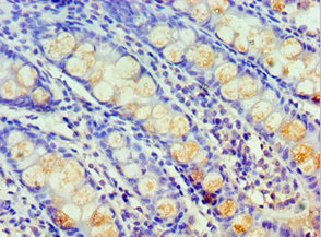 HARS Antibody in Immunohistochemistry (Paraffin) (IHC (P))