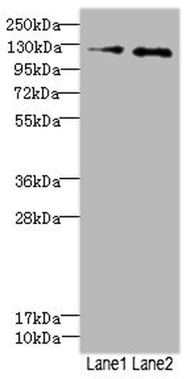 HEPH Antibody in Western Blot (WB)