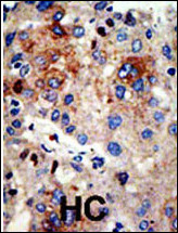 HDAC9 Antibody in Immunohistochemistry (Paraffin) (IHC (P))