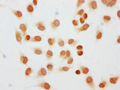 Di-Methyl-Histone H1.2 (Lys45) Antibody in Immunocytochemistry (ICC/IF)