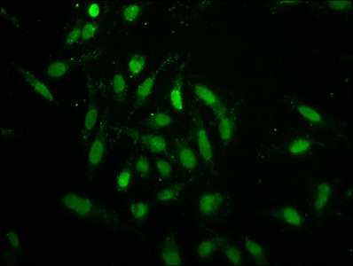 Formyl-Histone H1.2 (Lys96) Antibody in Immunocytochemistry (ICC/IF)