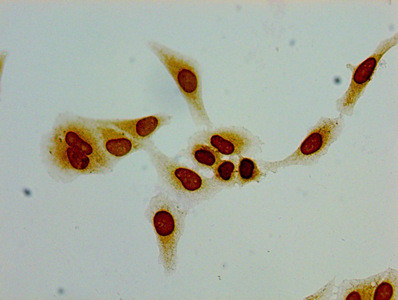 Acetyl-Histone H1.2 (Lys96) Antibody in Immunocytochemistry (ICC/IF)