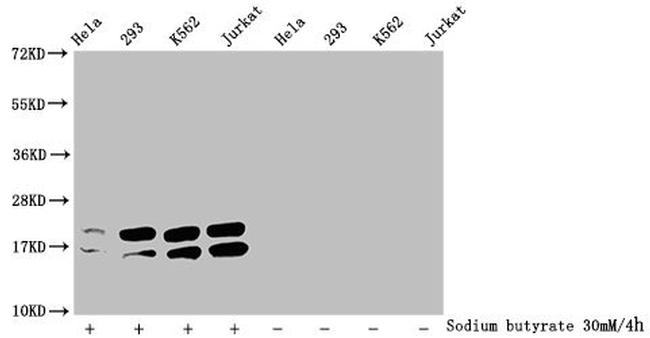 Acetyl-Histone H1.2 (Lys96) Antibody in Western Blot (WB)