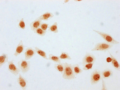 beta-hydroxybutyryl-Histone H1.3 (Lys106) Antibody in Immunocytochemistry (ICC/IF)