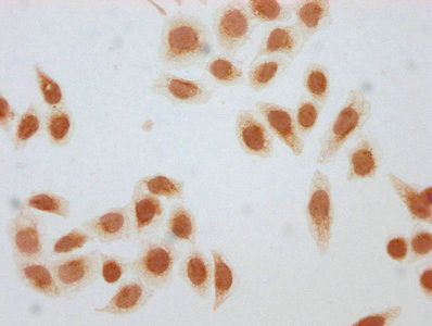 beta-hydroxybutyryl-Histone H1.3 (Lys75) Antibody in Immunocytochemistry (ICC/IF)