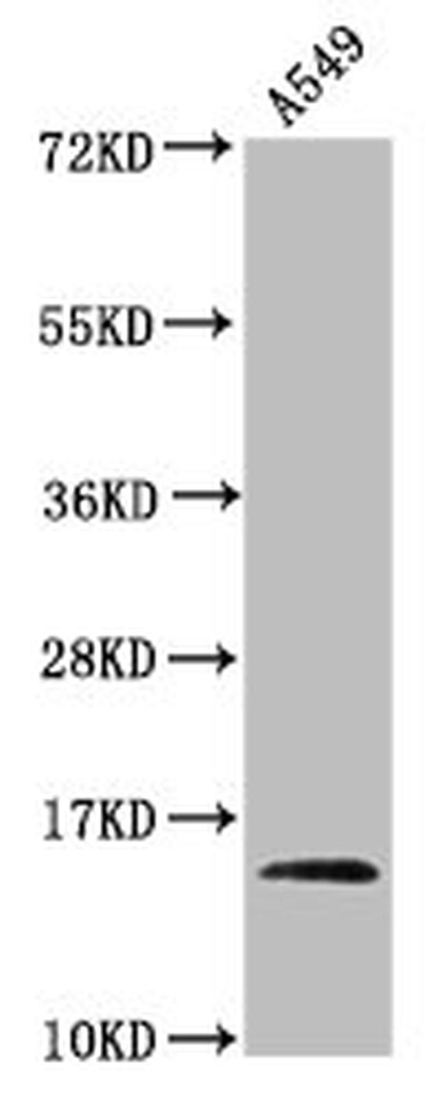 2-hydroxyisobutyryl-Histone Macro-H2A.1 (Lys9) Antibody in Western Blot (WB)