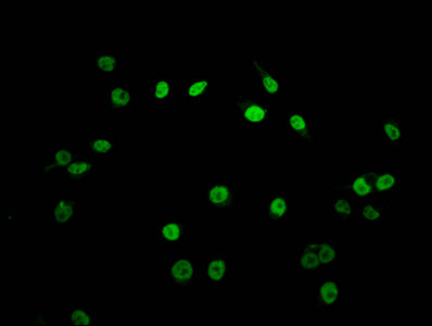 Formyl-Histone Macro-H2A.1 (Lys118) Antibody in Immunocytochemistry (ICC/IF)