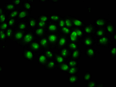 Acetyl-Histone Macro-H2A.1 (Lys13) Antibody in Immunocytochemistry (ICC/IF)