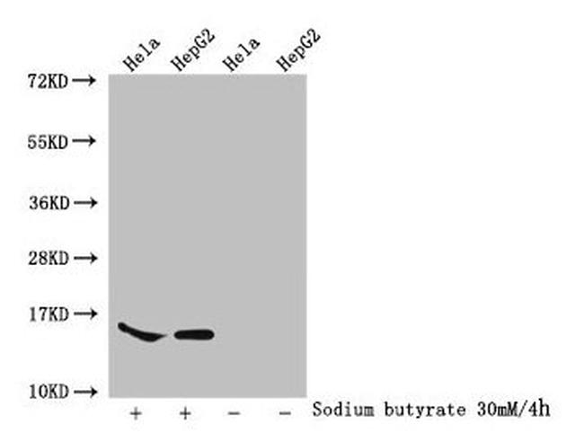 Acetyl-Histone Macro-H2A.1 (Lys74) Antibody in Western Blot (WB)