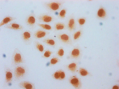 2-hydroxyisobutyryl-Histone Macro-H2A.1 (Lys74) Antibody in Immunocytochemistry (ICC/IF)