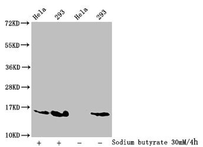 2-hydroxyisobutyryl-Histone Macro-H2A.1 (Lys74) Antibody in Western Blot (WB)