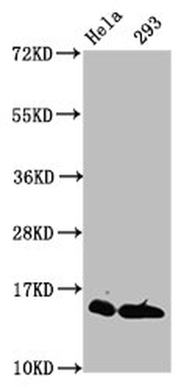 Crotonyl-Histone Macro-H2A.1 (Lys118) Antibody in Western Blot (WB)