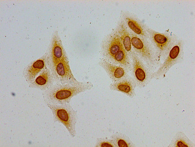 Acetyl-Histone Macro-H2A.1 (Lys36) Antibody in Immunocytochemistry (ICC/IF)