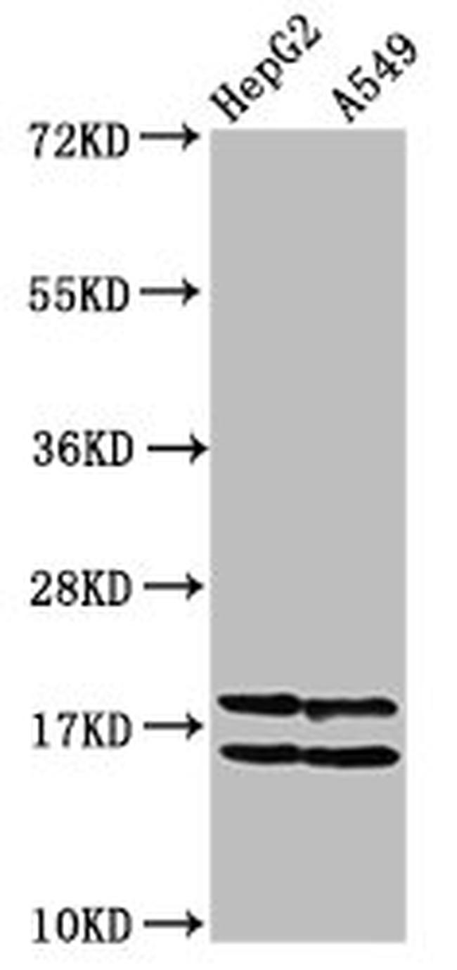 Acetyl-Histone Macro-H2A.1 (Lys36) Antibody in Western Blot (WB)