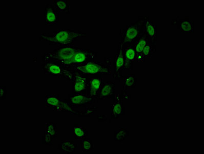 H2BK16ac Antibody in Immunocytochemistry (ICC/IF)