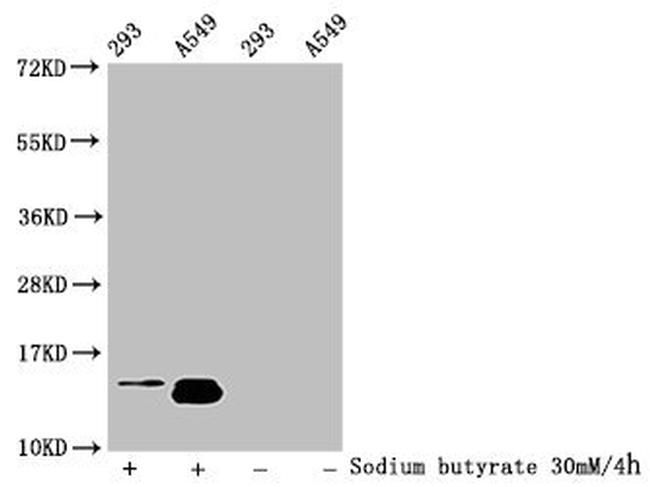 H2BK116ac Antibody in Western Blot (WB)