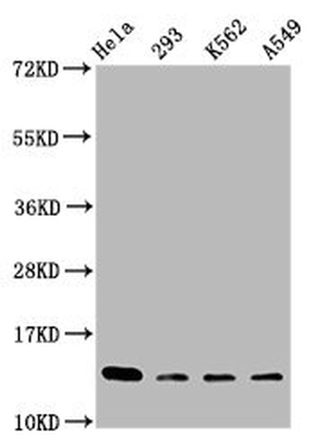 H2BK116me1 Antibody in Western Blot (WB)