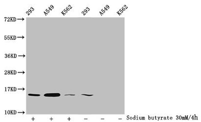 H2BK11ac Antibody in Western Blot (WB)