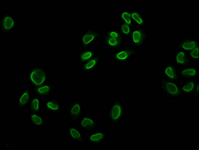 H2BK12ac Antibody in Immunocytochemistry (ICC/IF)