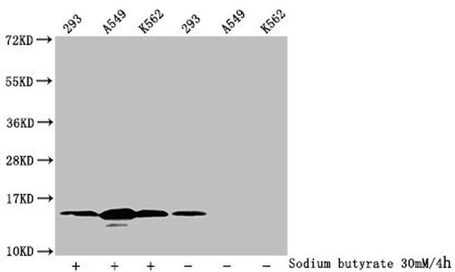 H2BK12ac Antibody in Western Blot (WB)