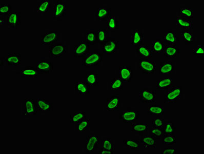 H2BK15ac Antibody in Immunocytochemistry (ICC/IF)