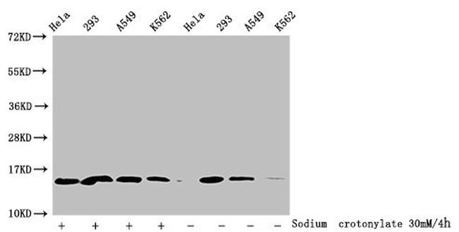 H2BK16cr Antibody in Western Blot (WB)