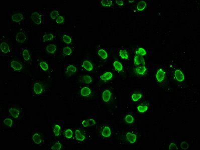 H2BK20ac Antibody in Immunocytochemistry (ICC/IF)