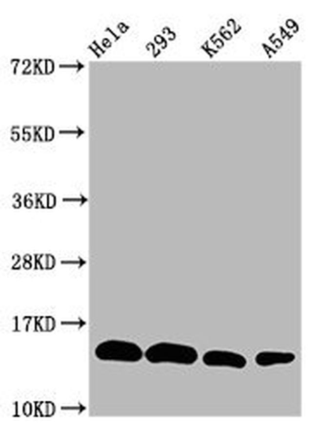 H2BK20me1 Antibody in Western Blot (WB)