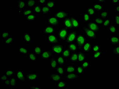 H2BK23cr Antibody in Immunocytochemistry (ICC/IF)