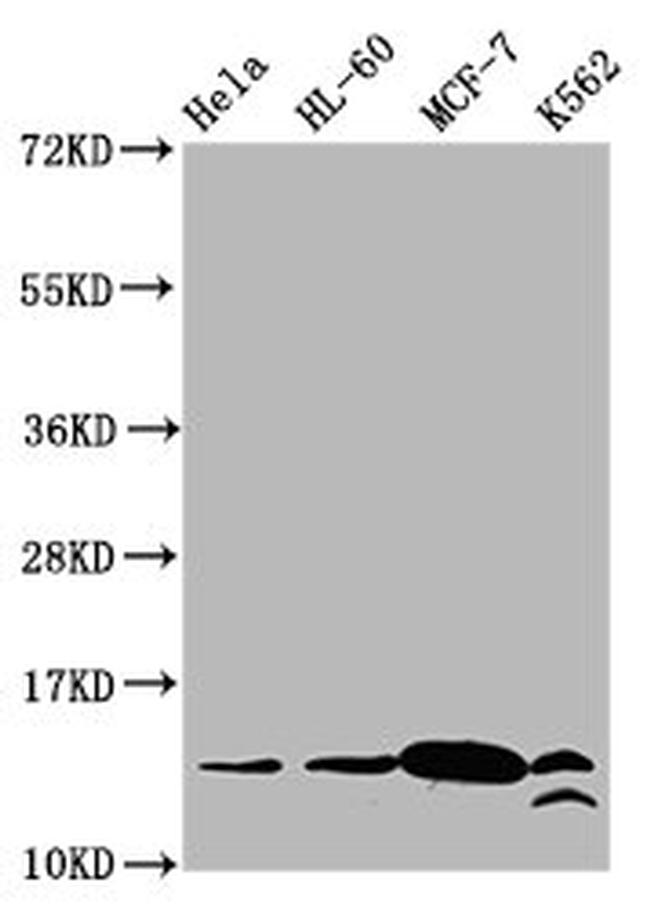 H2BK23cr Antibody in Western Blot (WB)