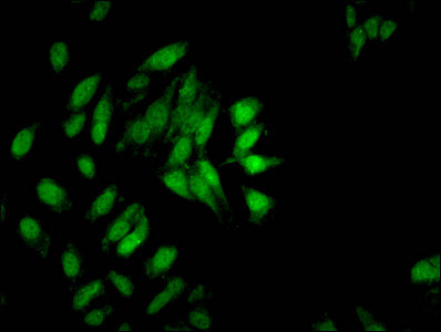 H3K9me2 Antibody in Immunocytochemistry (ICC/IF)