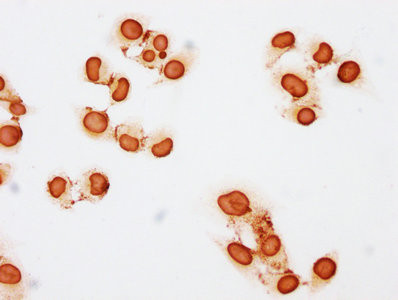 H3K23pr Antibody in Immunocytochemistry (ICC/IF)