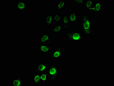 H3K23pr Antibody in Immunocytochemistry (ICC/IF)