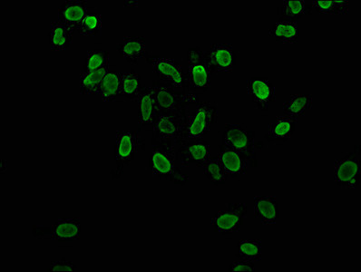 H3K36ac Antibody in Immunocytochemistry (ICC/IF)