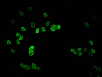 H3K9me2 Antibody in Immunocytochemistry (ICC/IF)