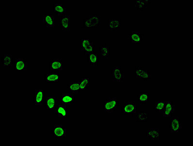 H3K36me2 Antibody in Immunocytochemistry (ICC/IF)