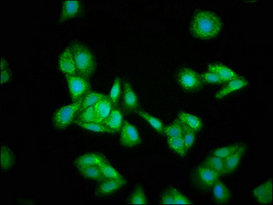 HMGCS2 Antibody in Immunocytochemistry (ICC/IF)