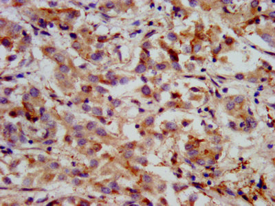 HMGCS2 Antibody in Immunohistochemistry (Paraffin) (IHC (P))