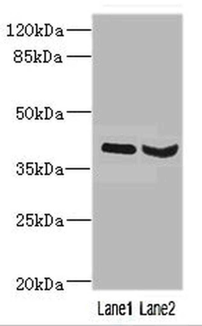 HOXD10 Antibody in Western Blot (WB)