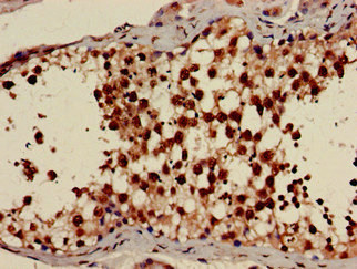 AMPK gamma-1 Antibody in Immunohistochemistry (Paraffin) (IHC (P))