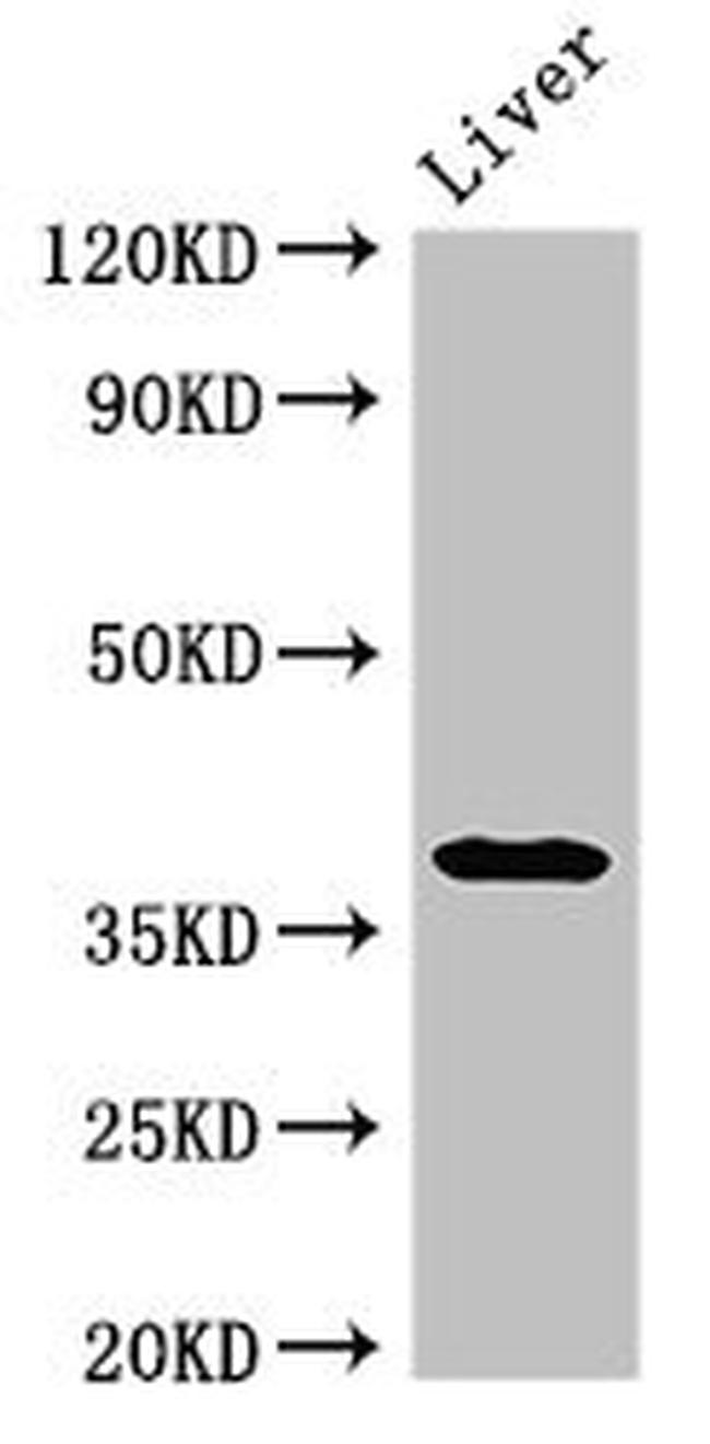 AMPK gamma-1 Antibody in Western Blot (WB)