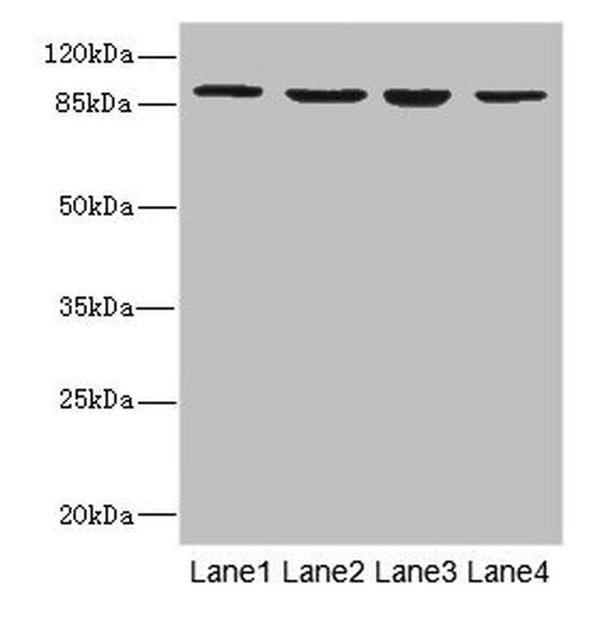 Integrin beta 7 Antibody in Western Blot (WB)