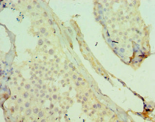 JMJD2B Antibody in Immunohistochemistry (Paraffin) (IHC (P))