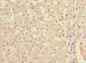 KHK Antibody in Immunohistochemistry (Paraffin) (IHC (P))