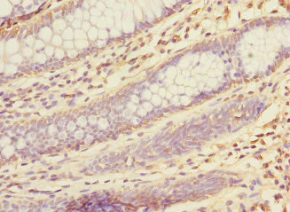 KHK Antibody in Immunohistochemistry (Paraffin) (IHC (P))