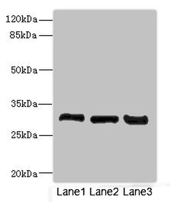 KHK Antibody in Western Blot (WB)