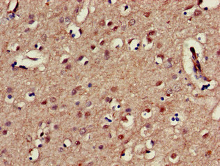 KIR3DL1 Antibody in Immunohistochemistry (Paraffin) (IHC (P))