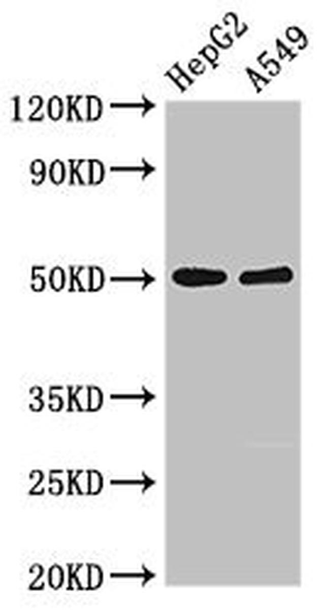 KIR3DL1 Antibody in Western Blot (WB)