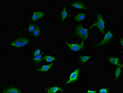 LANCL1 Antibody in Immunocytochemistry (ICC/IF)