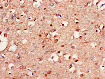 LANCL1 Antibody in Immunohistochemistry (Paraffin) (IHC (P))